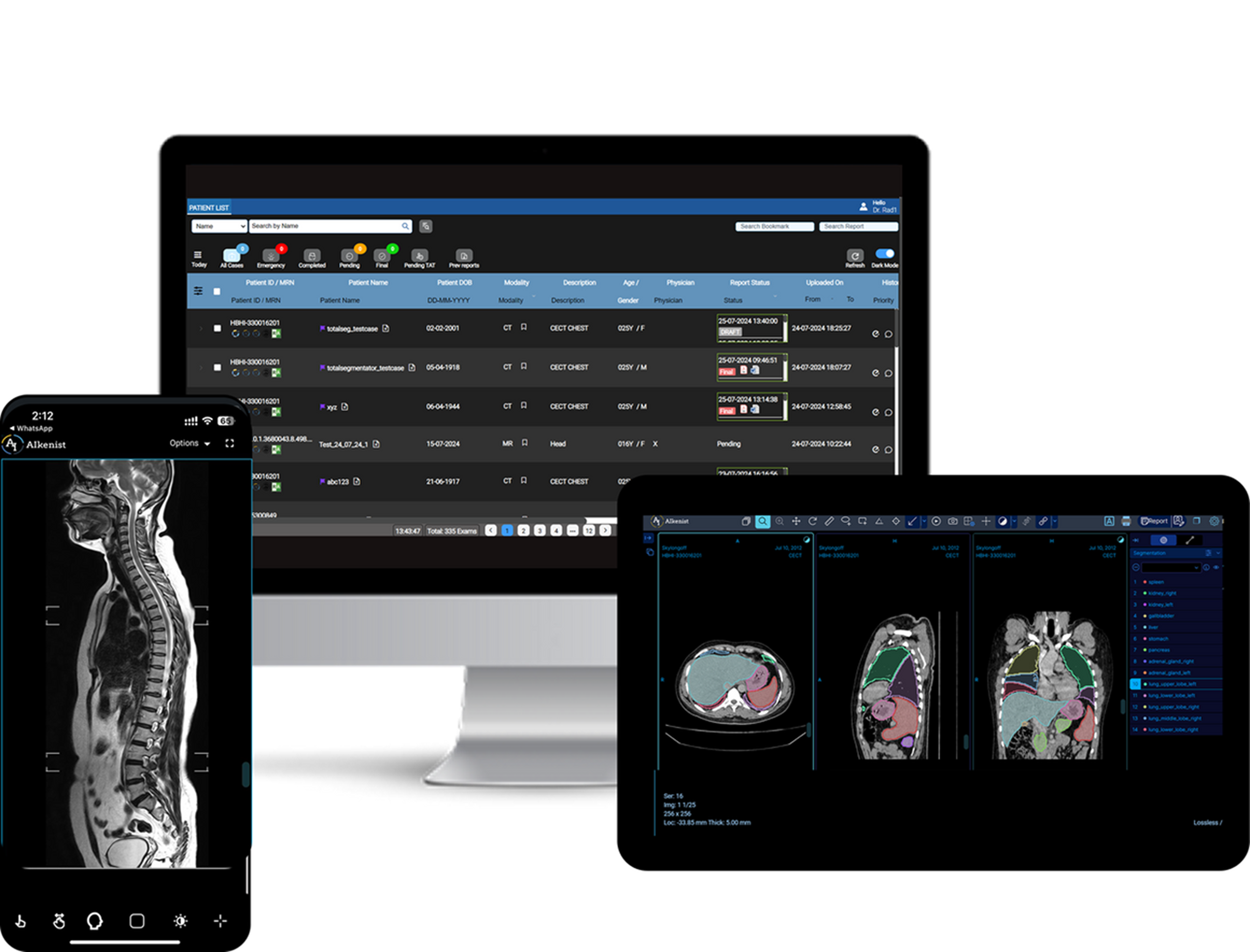 Aikenist at RSNA 2025