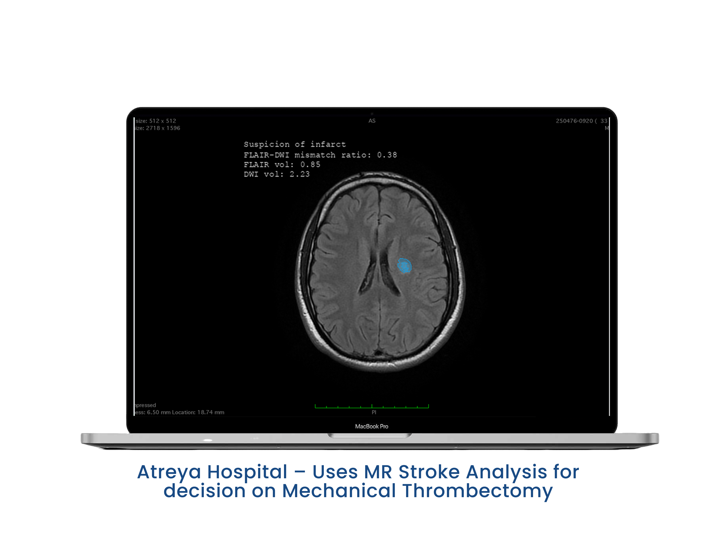 Aiken QuickFlow Dashboard