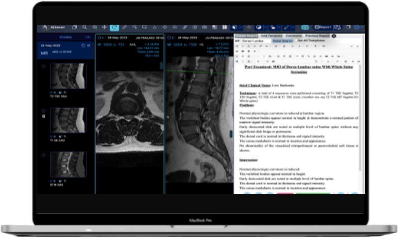 Aiken Reporting viewer with report editor beside spine MRI images