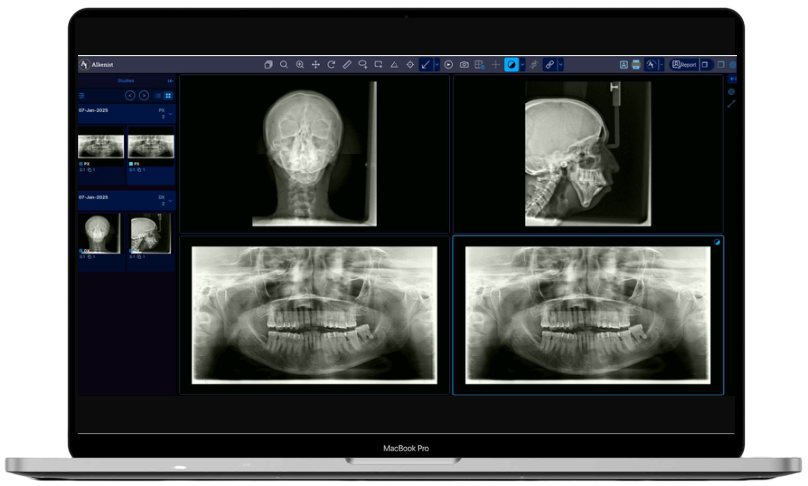 Dental PACS viewer showing cephalometric, panoramic and skull X-rays