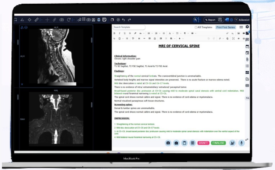 GenAI Reporting editor beside cervical spine MRI images
