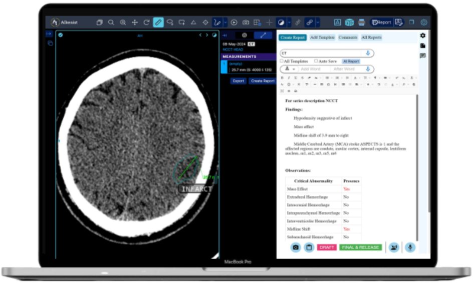 StrokeSuite CT stroke AI with auto-generated report